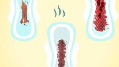 12 tipos de menstruação e o que eles dizem sobre