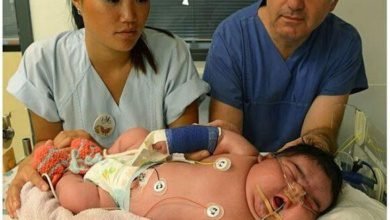 mulher com 250 kg dá à luz bebê de mais