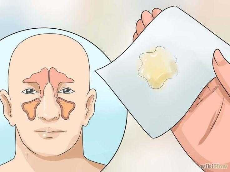 Como eliminar a congestão nasal em poucos minutos