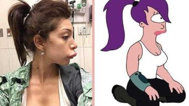 Atriz fez cirurgia para ter labios da Angelina Jolie, mas ficou a cara da Leela do Futurama!