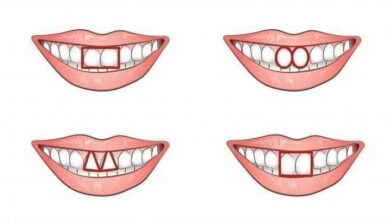 O formato dos dentes da frente revela muito sobre a sua personalidade