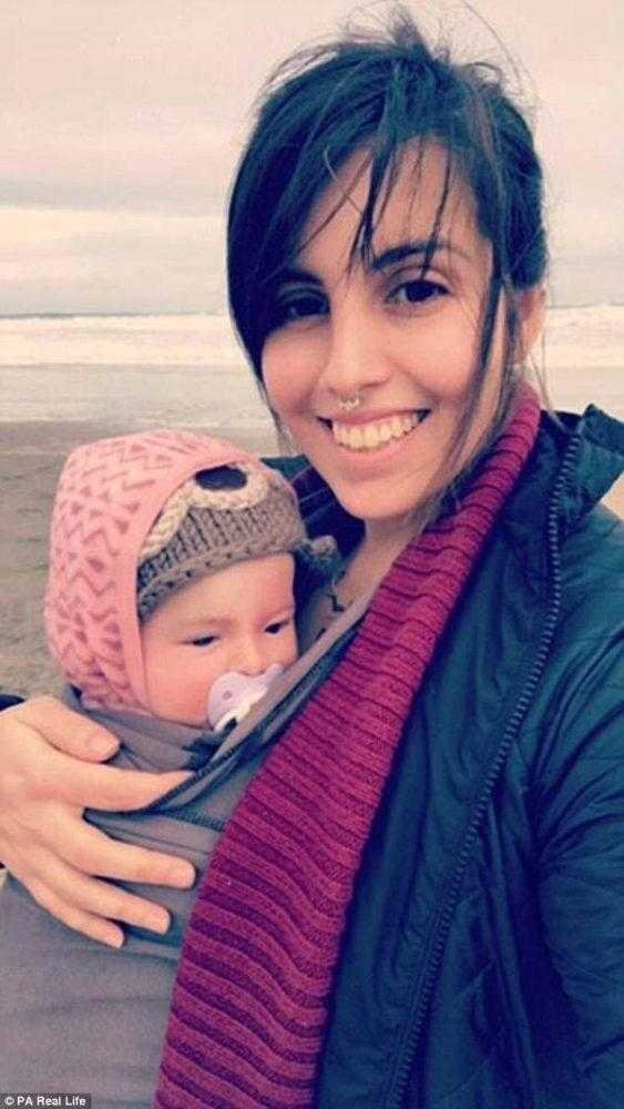 Bebê passa por transformação incrível após tratamento para manchas d