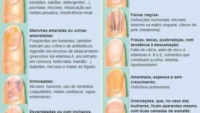 10 Sinais nas unhas que podem indicar problemas graves de saúde — Bau das DICAS