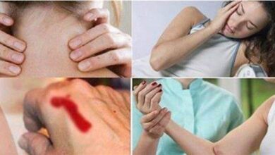 12 sinais de leucemia que são pouco conhecidos e muito ignorados — Bau das DICAS