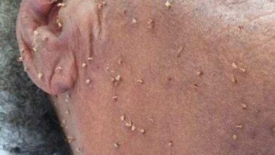 Senhora morre após ser picada por cerca de 500 abelhas — Bau das DICAS