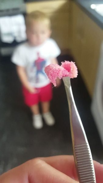 1502846105 85 mae fica chocada ao descobrir o que causava mau halito no filho vejam