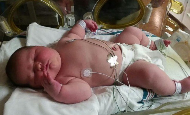 1503329783 726 bebe nasce com mais de 6kg e impressiona medicos