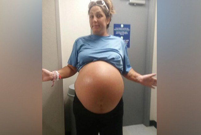 1503329783 92 bebe nasce com mais de 6kg e impressiona medicos