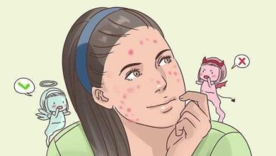 7 hábitos que dão muita acne e você nem imaginava — Bau das DICAS