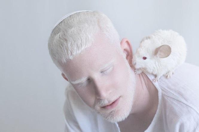 12 fotos que mostram a beleza cativante de pessoas albinas