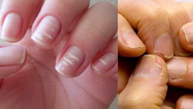 10 alertas que as suas unhas podem te mostrar — Bau das DICAS
