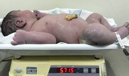 Bebezão de quase 6kg tem alta de hospital após nove dias: 'Muito contente', diz mãe