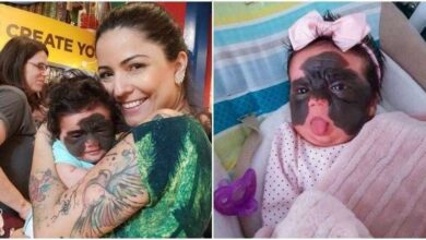 Bebê é chamada de monstro por causa de sua aparência e mãe desabafa d d