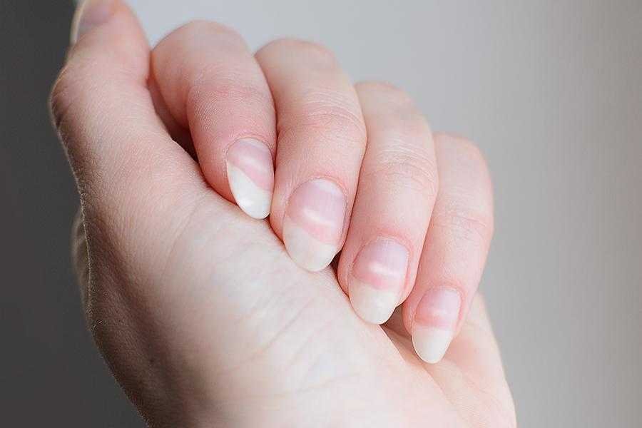 6 dicas para ter unhas fortes e bonitas