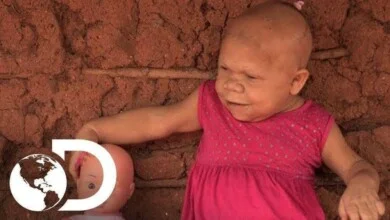 A Incrível história de Maria, uma mulher brasileira presa num corpo de bebê — Bau das DICAS