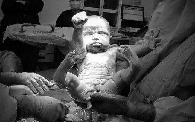 bebê nasce fazendo pose de super homem d