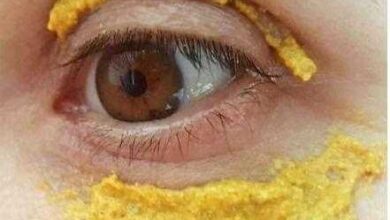 Benefícios de aplicar açafrão em volta dos olhos 00S