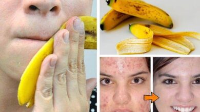 Como Eliminar Espinhas com Casca de Banana — Bau das DICAS