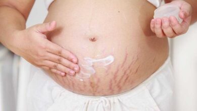 Como tratar as estrias da barriga após a gravidez 5