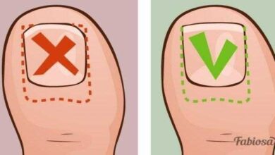 Ela sofria com unhas encravadas por vários anos até que aprendeu essas dicas simples — Bau das DICAS