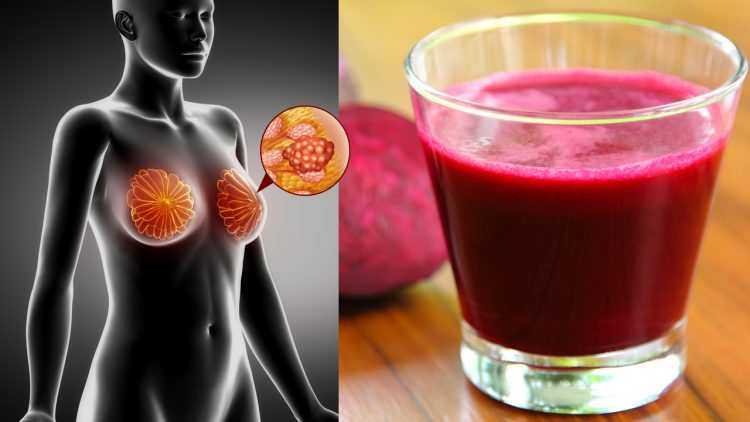este suco previne o cancer limpa seu figado e reduz a pressao alta