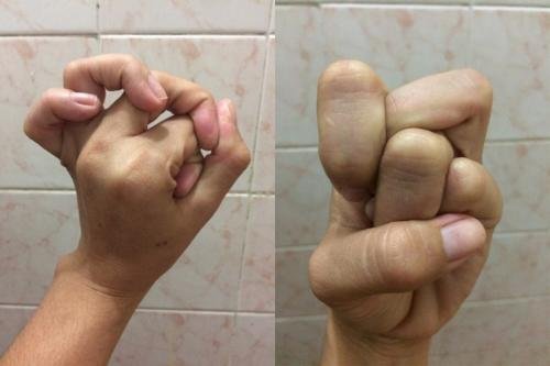 novo desafio que esta bombando nas redes sociais voce e capaz de fazer dedos tortos