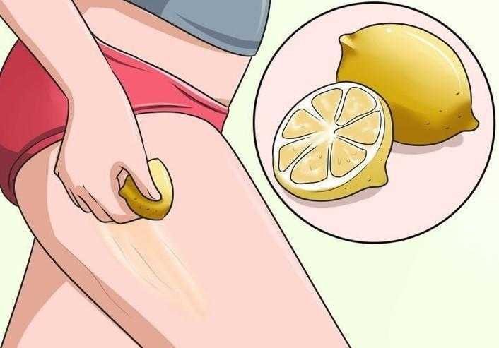 10 Dicas Para Eliminar Estrias Naturalmente