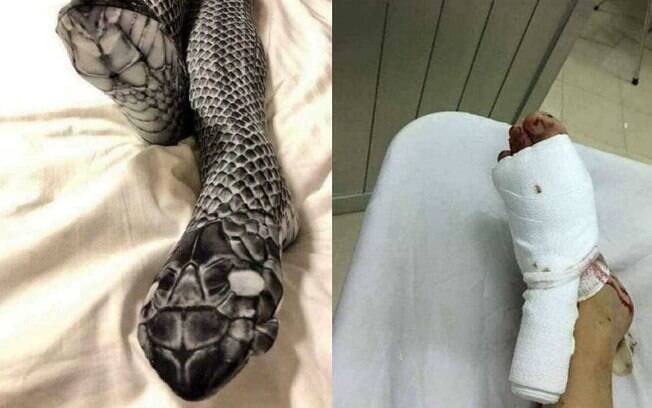 Mulher usa meia-calça diferente, assusta o marido e vai parar no hospital
