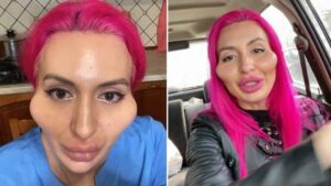 ‘Monstro bonito’: mulher muda visual e deixa os internautas chocados; médico faz importante alerta