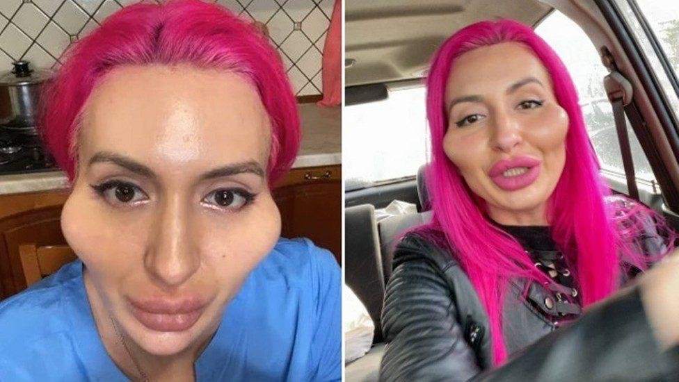 ‘Monstro bonito’: mulher muda visual e deixa os internautas chocados; médico faz importante alerta