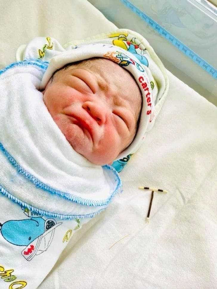 bebê ao lado DIU