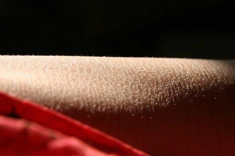 5 coisas que sua pele revela sobre você
