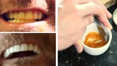 curcuma-dentes5