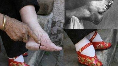 Confira Fotos Chocantes Da Antiga Tradição Chinesa • Bau Das DICAS