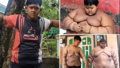 Menino Mais Gordo Do Mundo, Que Pesava 190 Quilos, Passa Por Incrível Transformação • Bau Das DICAS