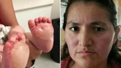 Bebê Fica Com Bolhas Enormes Em Seus Pés. Mas Depois, Sua Mãe Descobre O Que A Babá Horrível Fez! • Bau Das DICAS