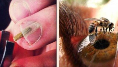 7 Imagens Perturbadoras Que Vão Chocar Você • Bau Das DICAS