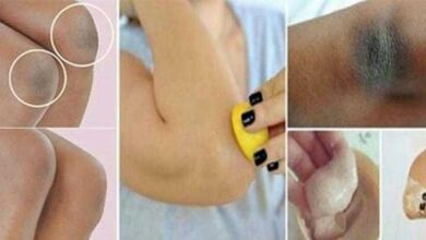 3 Receitas caseiras para clarear cotovelos e joelhos dd