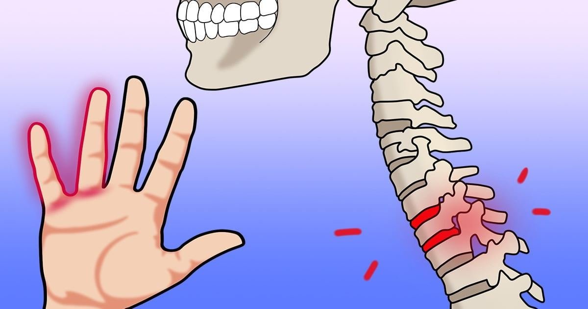 7 motivos que explicam porque você sente formigamento nas mãos