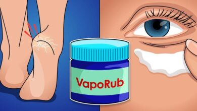 8 Utilidades Do Vick Vaporub Que Você Não Conhece • Bau Das DICAS