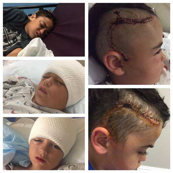 Garoto de 10 anos estava agindo estranho após ter brincado na rua. 2 dias depois, o que a mãe viu na cabeça dele a deixou desesperada!