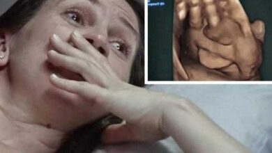 Gestante come chocolate antes de ultrassom e vê a reação do bebê
