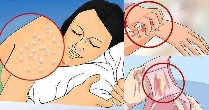 Você pode estar com HIV sem saber! Veja quais são os sintomas