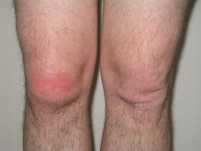 10 partes do corpo que doem por causa de pensamentos negativos 8 10 partes do corpo que doem por causa de pensamentos negativos 8