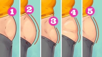5 tipos de barriga que não são causados pelo excesso de peso d