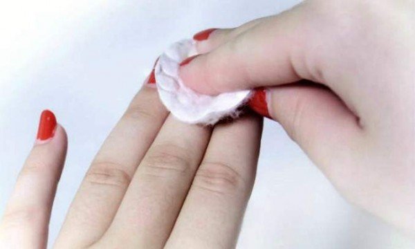 remover