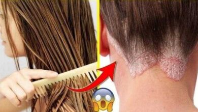 5 Razões para não dormir com o cabelo molhado d