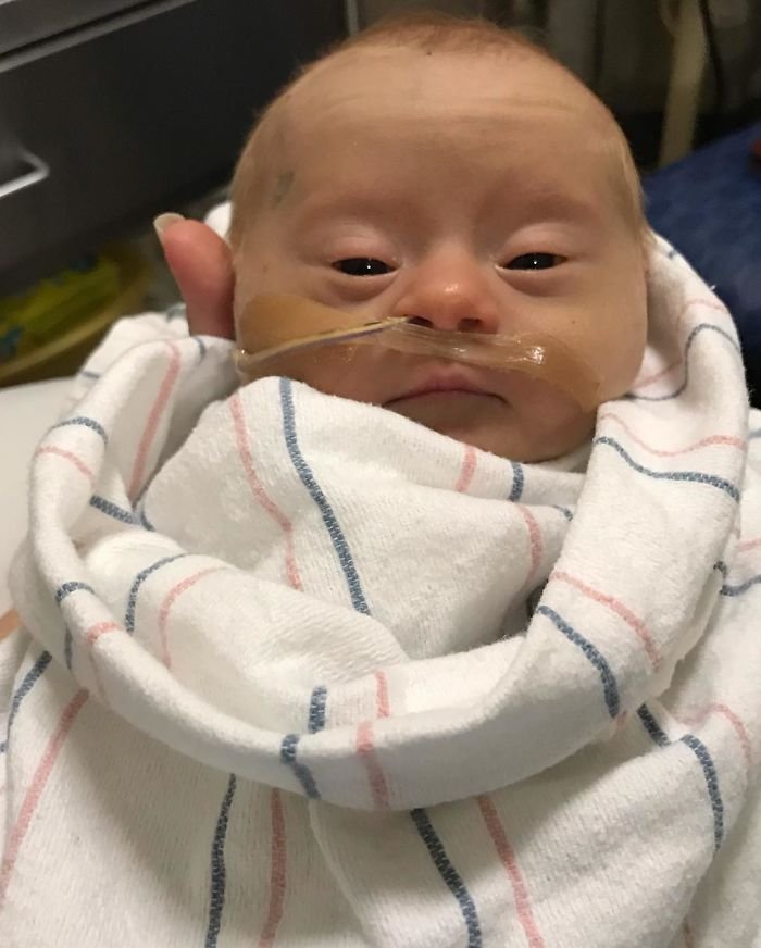 1583258199 596 Mae compartilha sua “visao” honesta de seu bebe com sindrome
