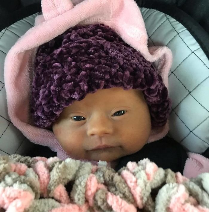 1583258196 575 Mae compartilha sua “visao” honesta de seu bebe com sindrome