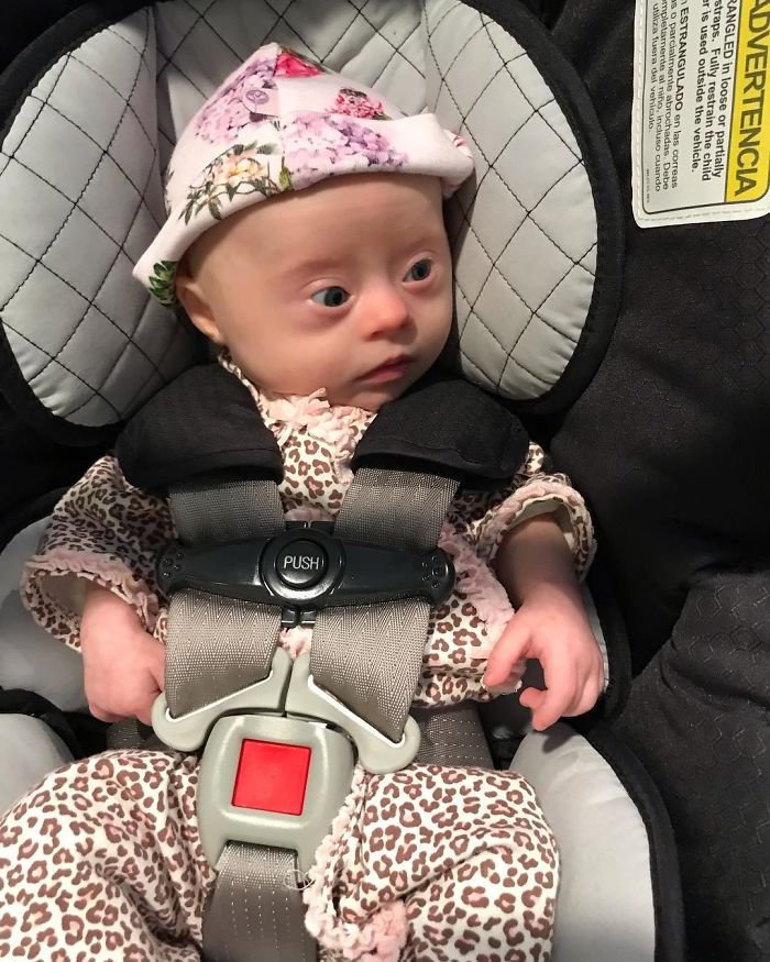 1583258198 581 Mae compartilha sua “visao” honesta de seu bebe com sindrome